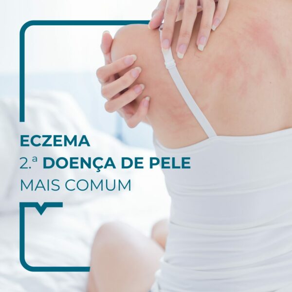 Mulher coçando as costas
