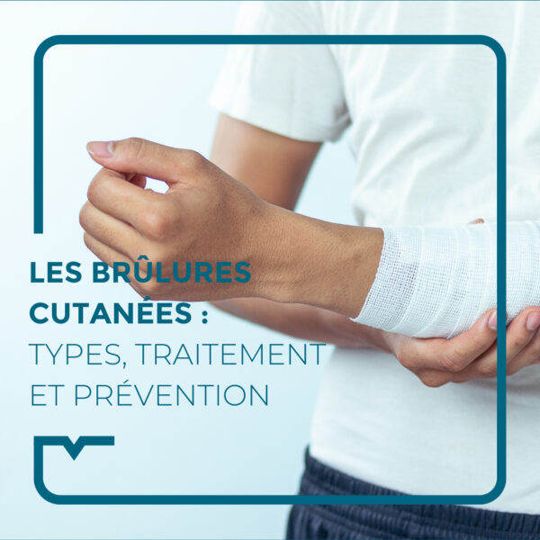 Brûlure cutanée sur le bras entourée d'un bandage