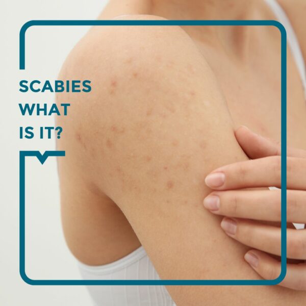 Woman scratching herself because she has scabies