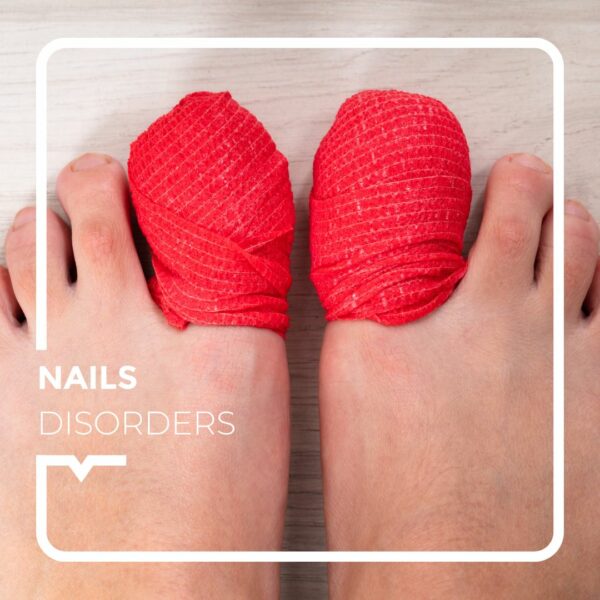 Toenails bandaged in red on red background