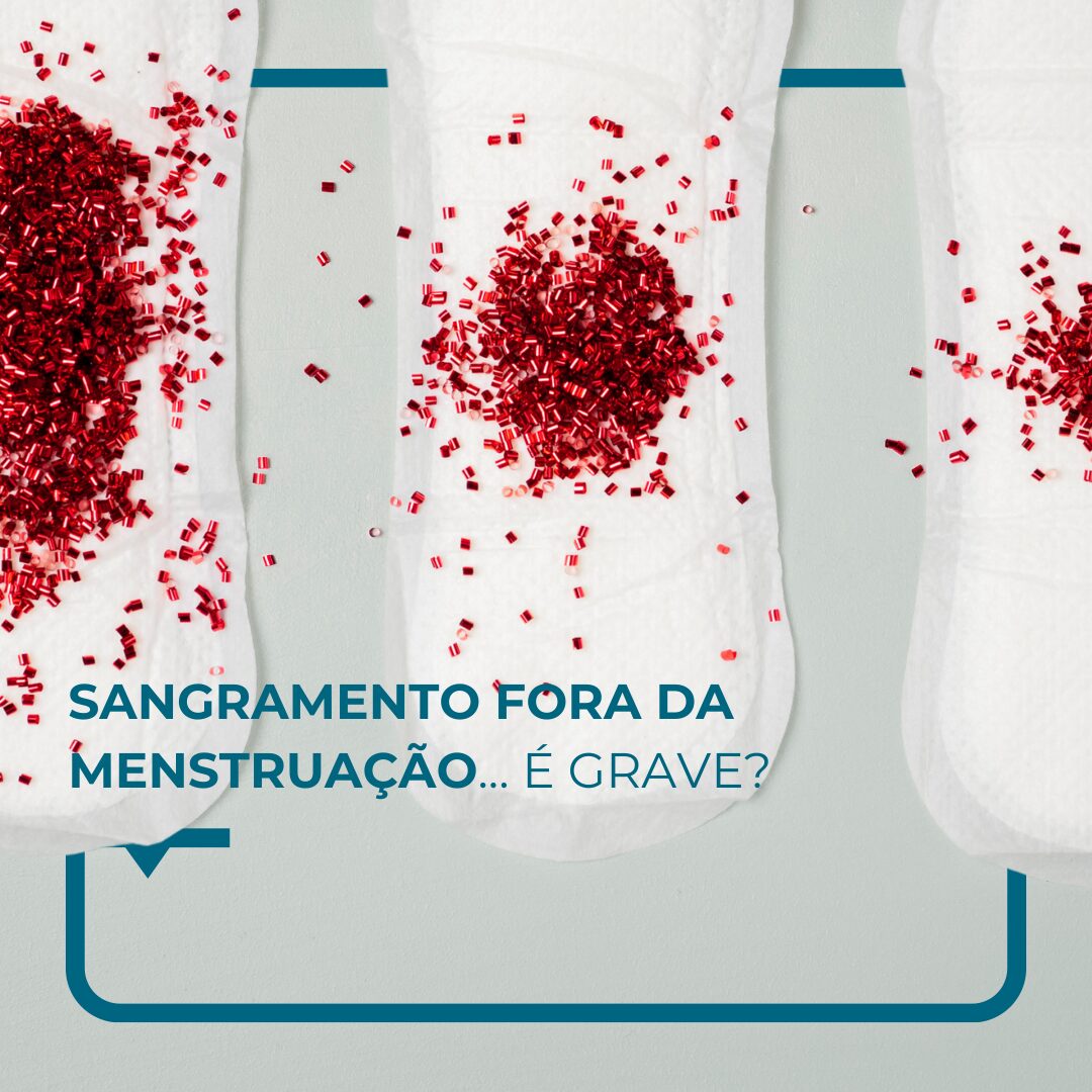 Sangramento fora da menstruação... é grave? - Alegria Medical Centre