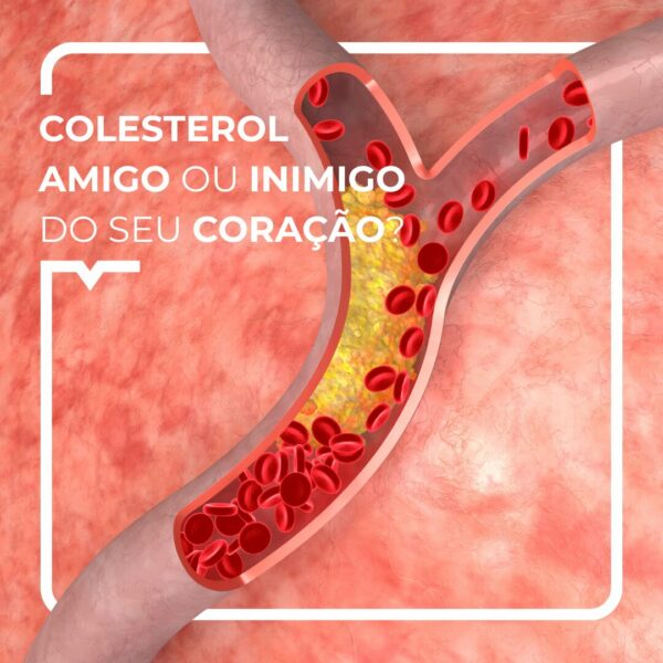 colesterol